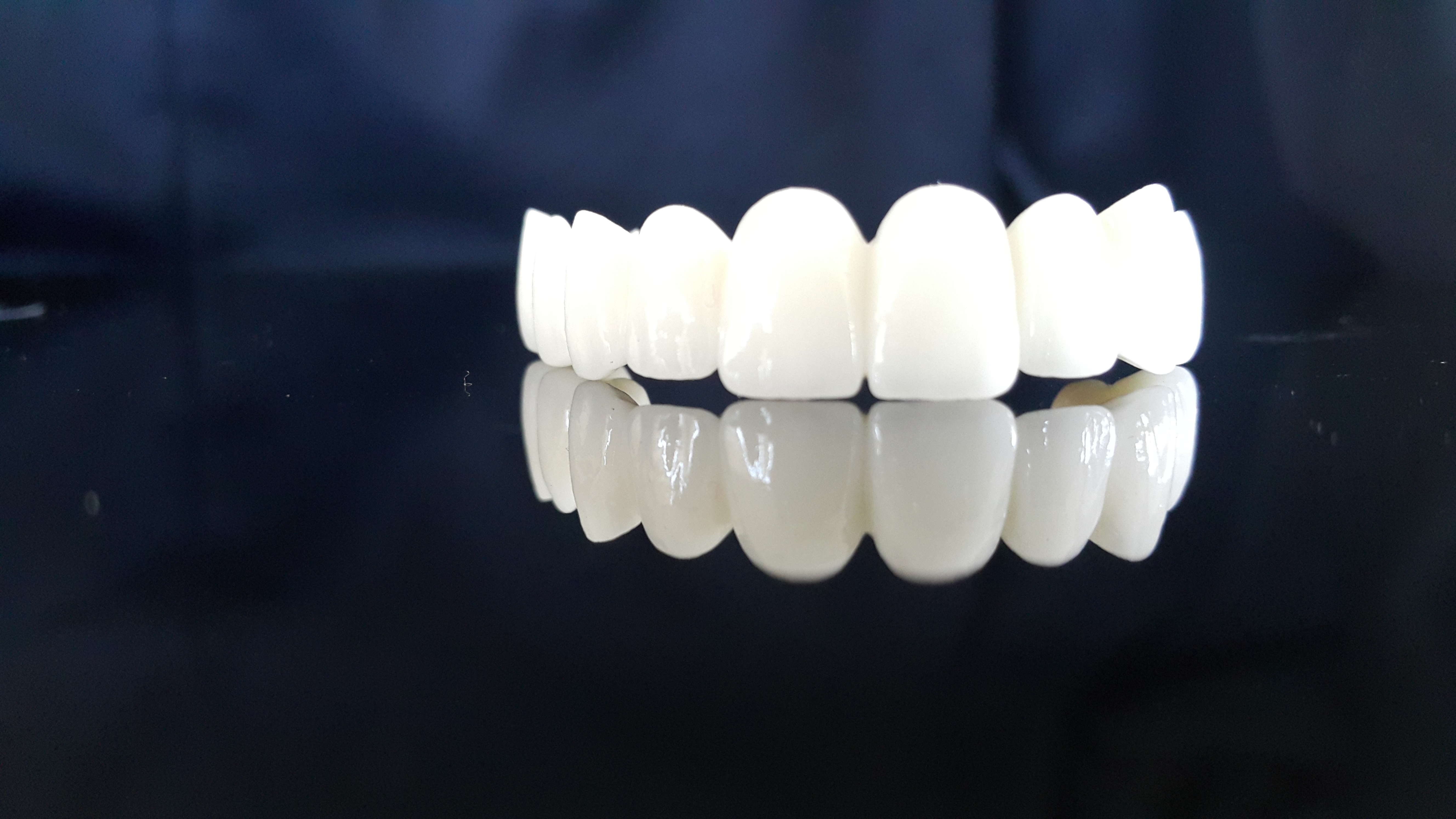 Seramik Braket Tekniği